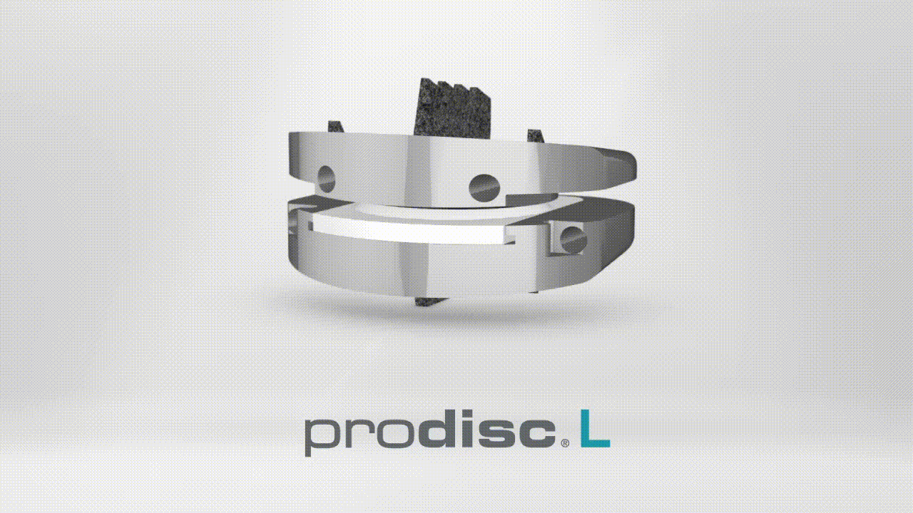 Lumbar Disc Replacement